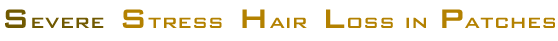 Severe Stress Hair Loss in Patches heading